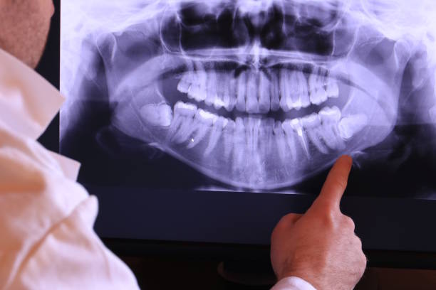 Best Dentist for Severe Toothache  in Joanna, SC